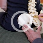 Demonstration of a Lower Lumbar Correction Part I